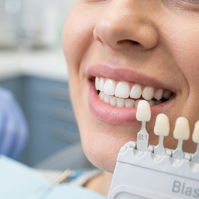 Diş Beyazlatma Yöntemleri